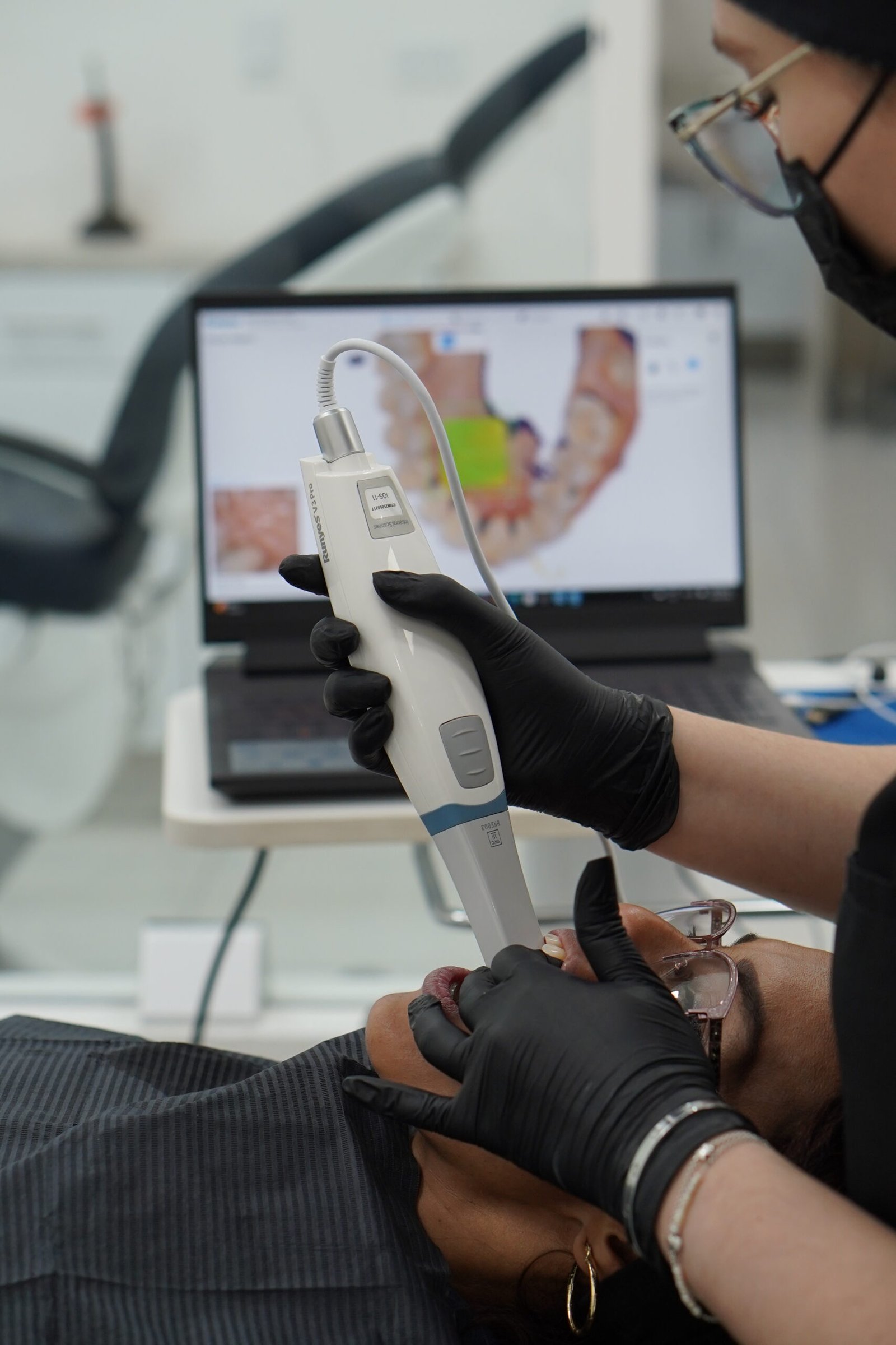 Digital 3D scanning